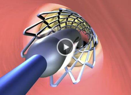 Click to play movie